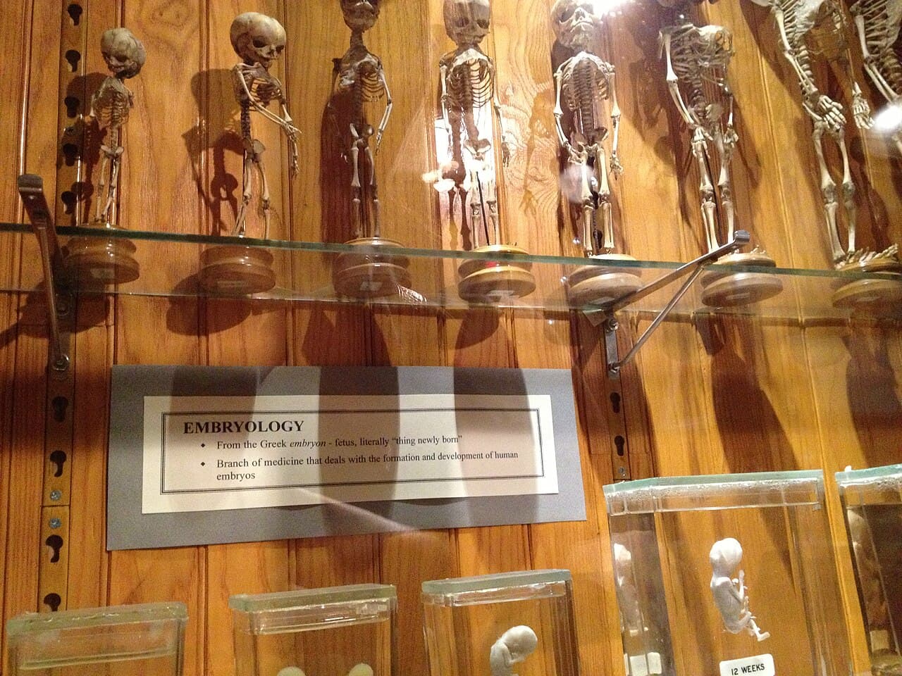 Mütter Museum
